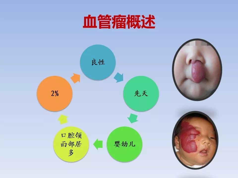 教學ppt血管瘤脈管畸形的聚桂醇硬化治療