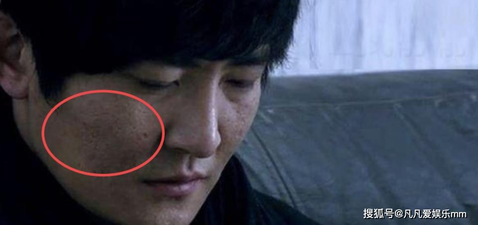 40岁郭京飞承认整容?但除了眼袋,另外三处也被质疑