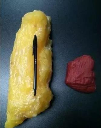 减腹部腰部脂肪_腰部肚子减肥_如何减掉肚子和腰部脂肪