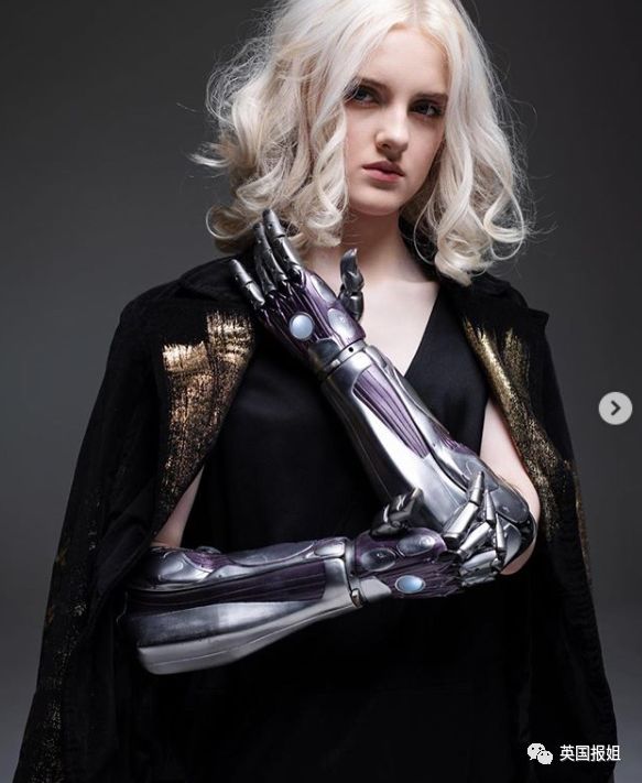 她自幼失去双手,却在14岁成为又美又飒的少女模特!_tilly