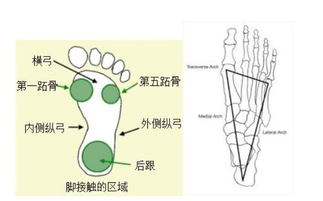 扁平足足底筋膜炎内八字步高弓足等足部疾病用成品鞋垫还是用矫形鞋垫