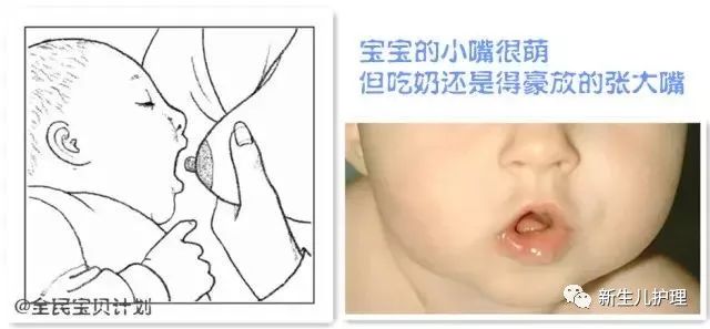 张大嘴含上乳房是正确的做法,如果只张开一点点,靠妈妈硬塞.