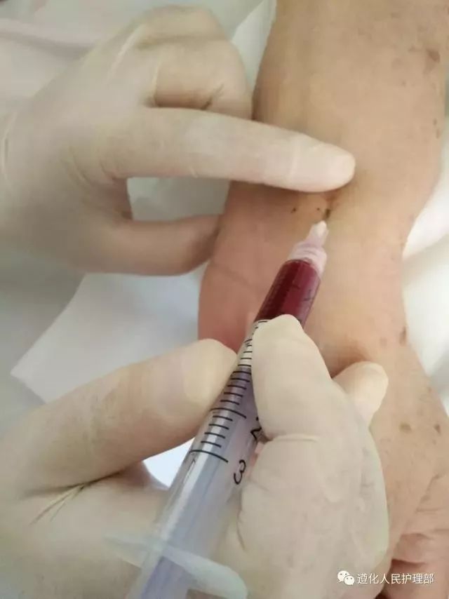 呼吸内科几名护士,动脉采血技术高超,功夫了得,以"一针见血""无痛"而