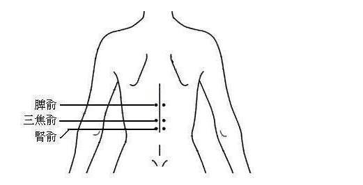 拒绝糖尿病,灸透胰俞穴