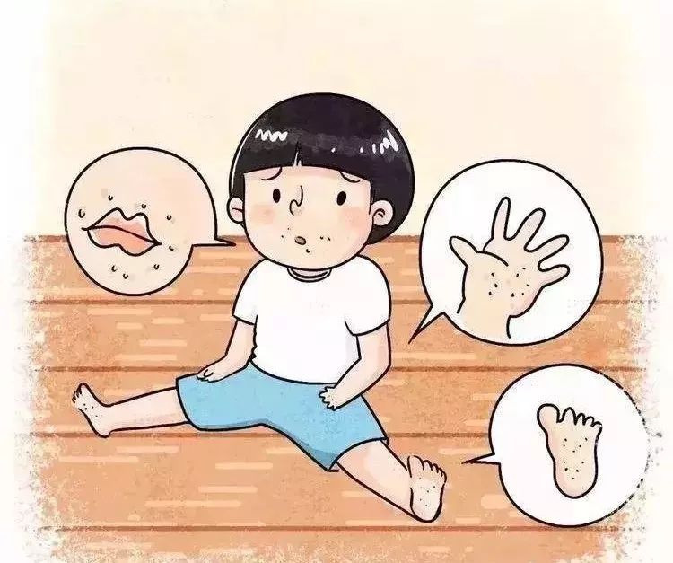 【手足口病】小儿手足口病多久能好_儿童怎样预防手足口病