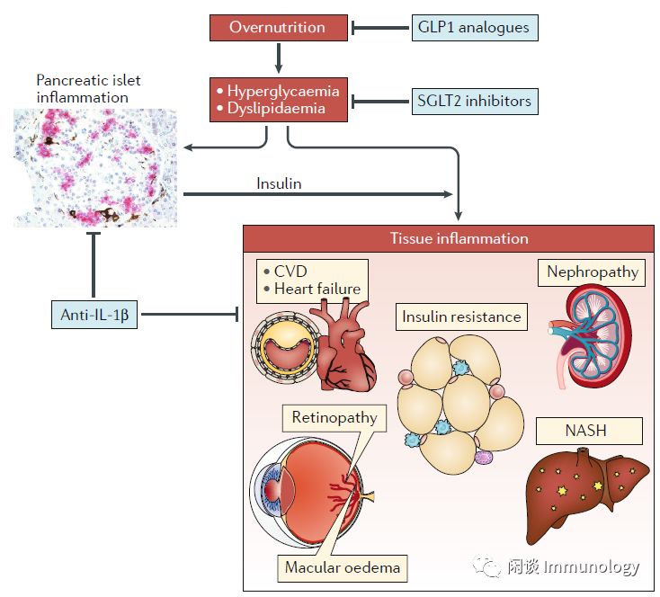 糖尿病免疫病理机制及靶向药物的进展