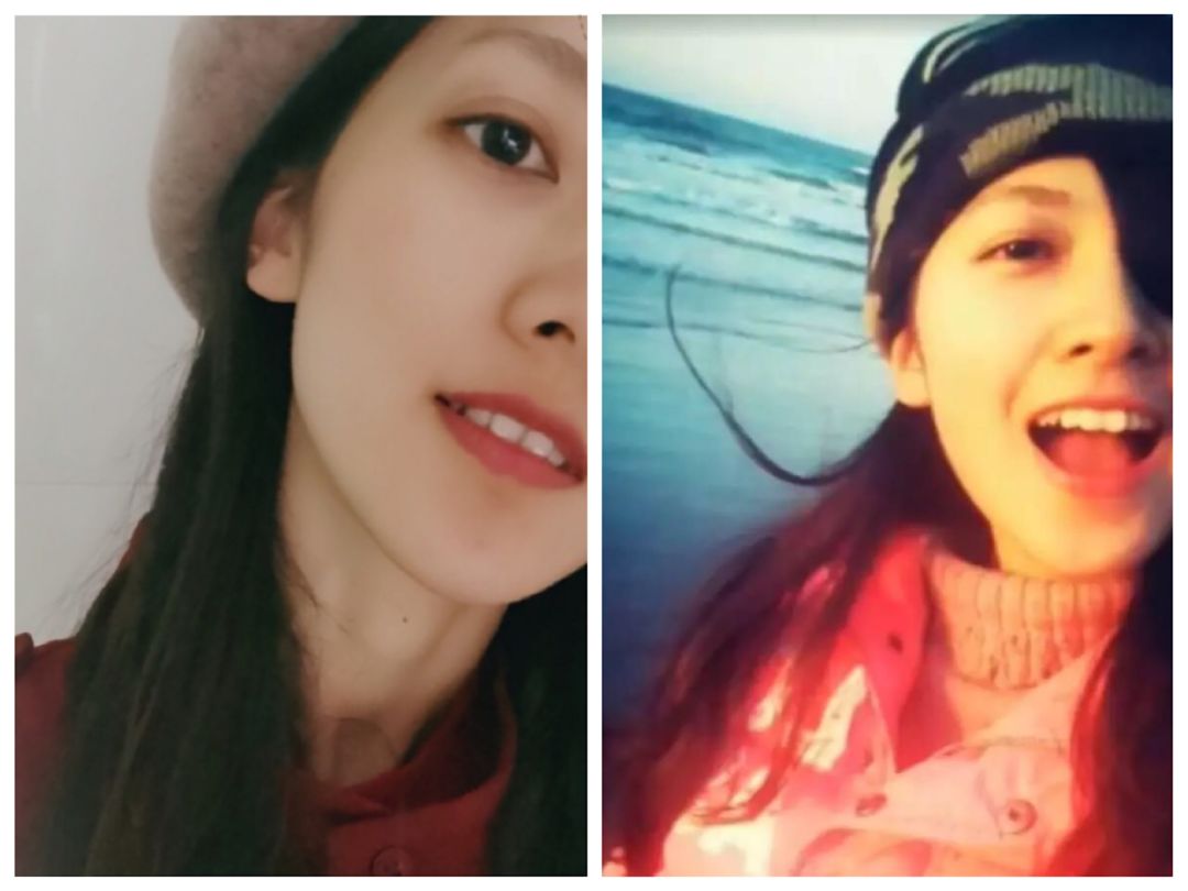 广东最美独眼女孩没什么大不了因为一只眼也能做得很好