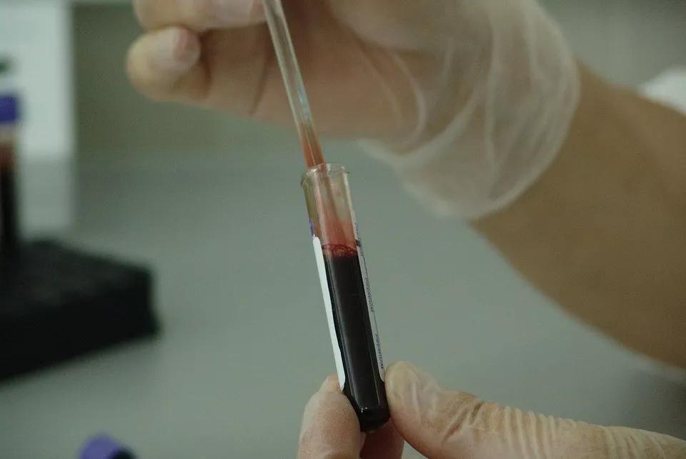 动脉血是什么颜色 来自搜狐网
