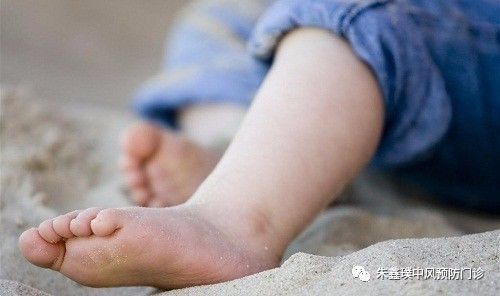 由于下肢静脉曲张有遗传倾向,一般在30岁左右发病,因此在儿童和青少年