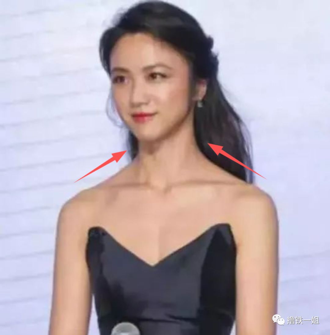 想想你的脖子和肩膀原本是两个相对独立的个体,突然有一天斜方肌跳