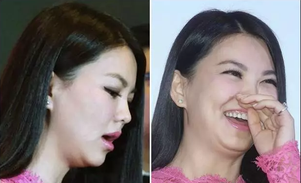 脖子比以前粗了,怎么减脖子 还有些人下巴有很多赘肉,看起来就像没