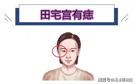 女人少田宅痣图片