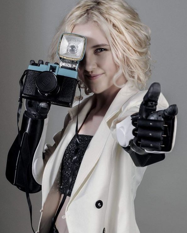 她自幼失去双手,却在14岁成为又美又飒的少女模特!_tilly