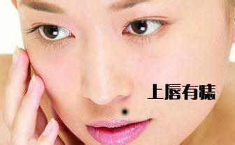 这些幸运痣你有几颗据说拥有的人无不命好财厚福气多