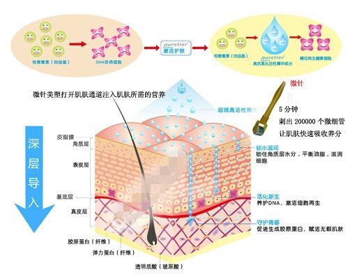 令人千疮百孔的微针真的有用吗?