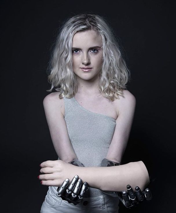 她自幼失去双手,却在14岁成为又美又飒的少女模特!_tilly