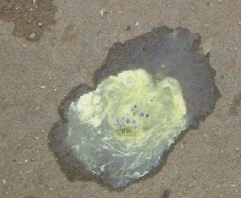 五颜六色的粪便背后隐藏着什么鸡粪又和肝脏疾病有怎样的联系呢