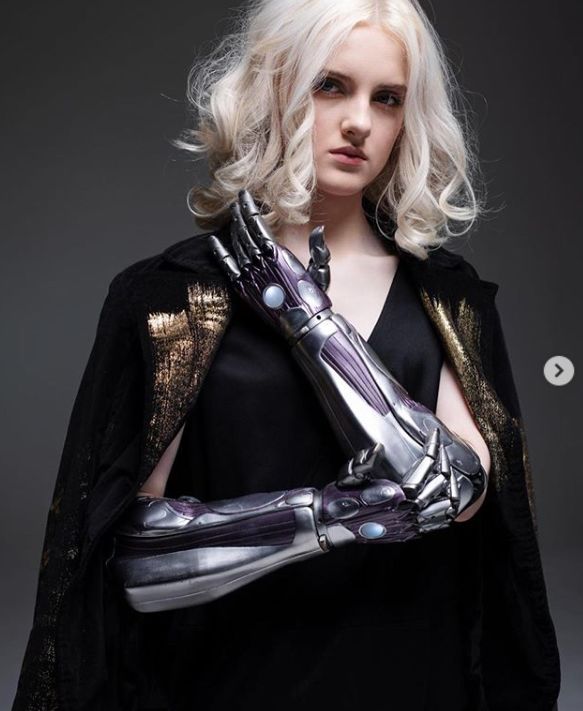 她自幼失去双手,却在14岁成为又美又飒的少女模特!_tilly