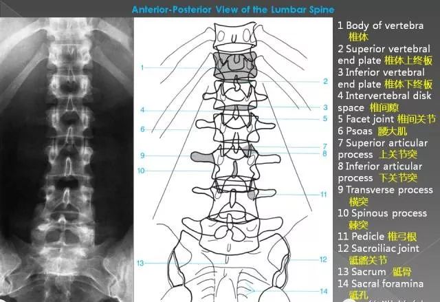 超详细的腰椎x线解剖及解读