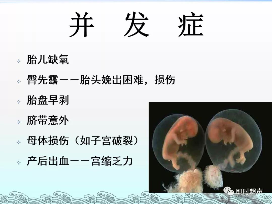 由錢瀅老師講解的《先天性子宮畸形的超聲診斷》在即時超聲千聊直播間