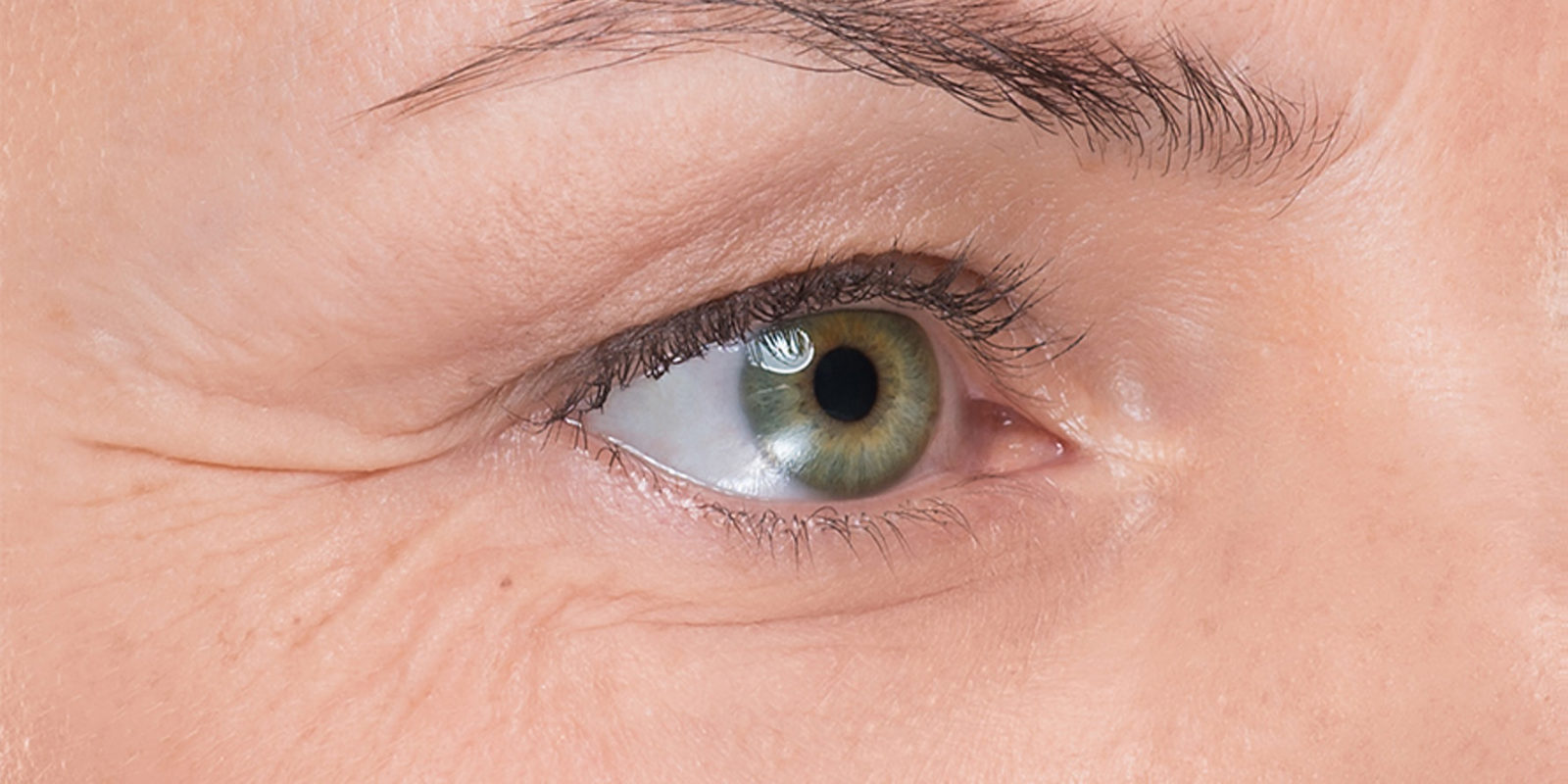 男生改善鱼尾纹方法如何去除鱼尾纹