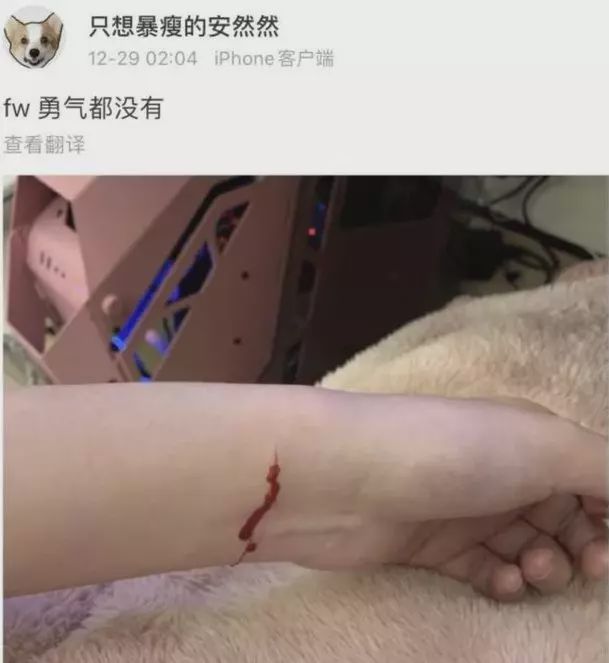 原创lol:"猪狗大战"小虎胜,rng德杯夺冠,小虎女友赛前割腕引热议