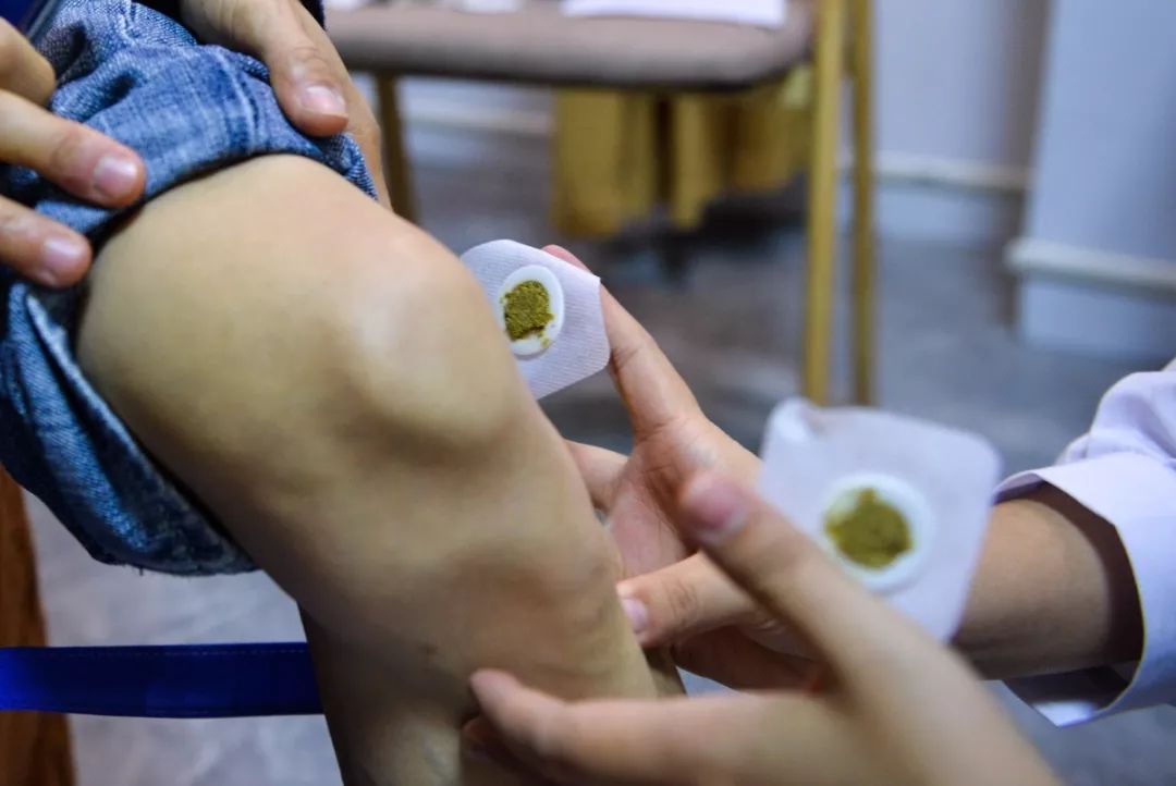 最冷三九天天灸种温暖