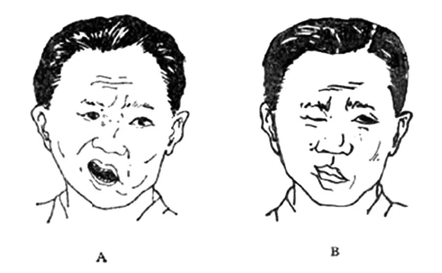 薄荷,艾葉,荊芥,前胡各15克.