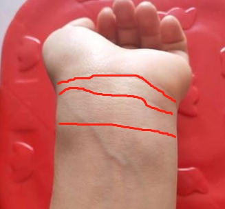 手腕线代表什么含义你手掌有几条手腕线