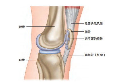 髌骨尖位置图片