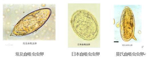 日本血吸虫卵形态图片