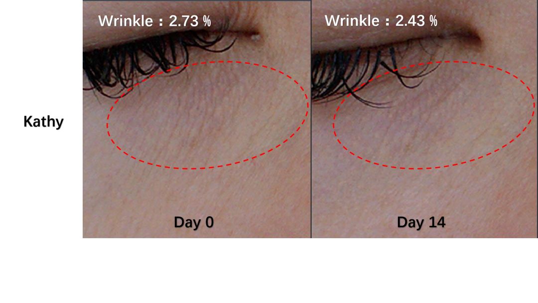 对25 轻熟龄肌面临秋冬干燥气候变化,或30 熟龄肌皮脂分泌量下降来说