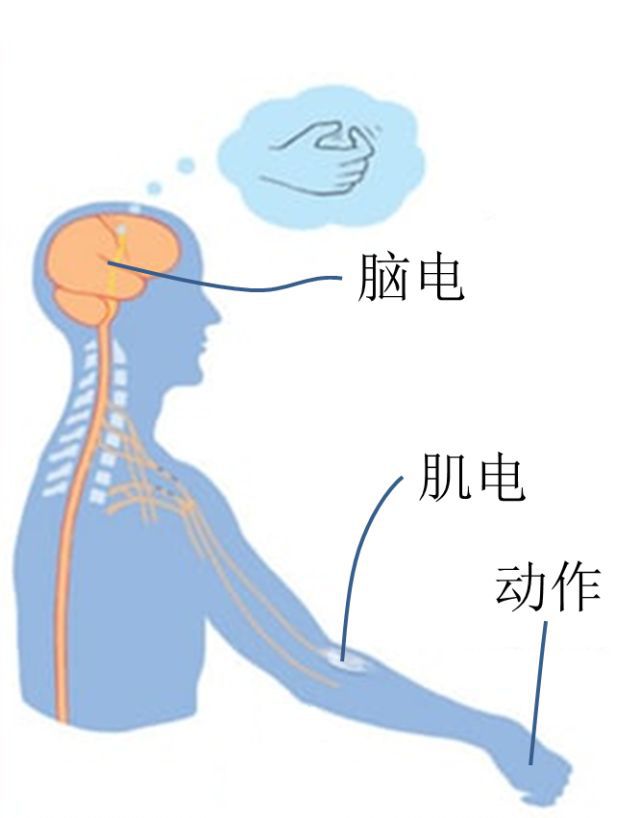 axonics的仿生手通过特殊的传感器搜集用户残肢的肌电信号投射到机械