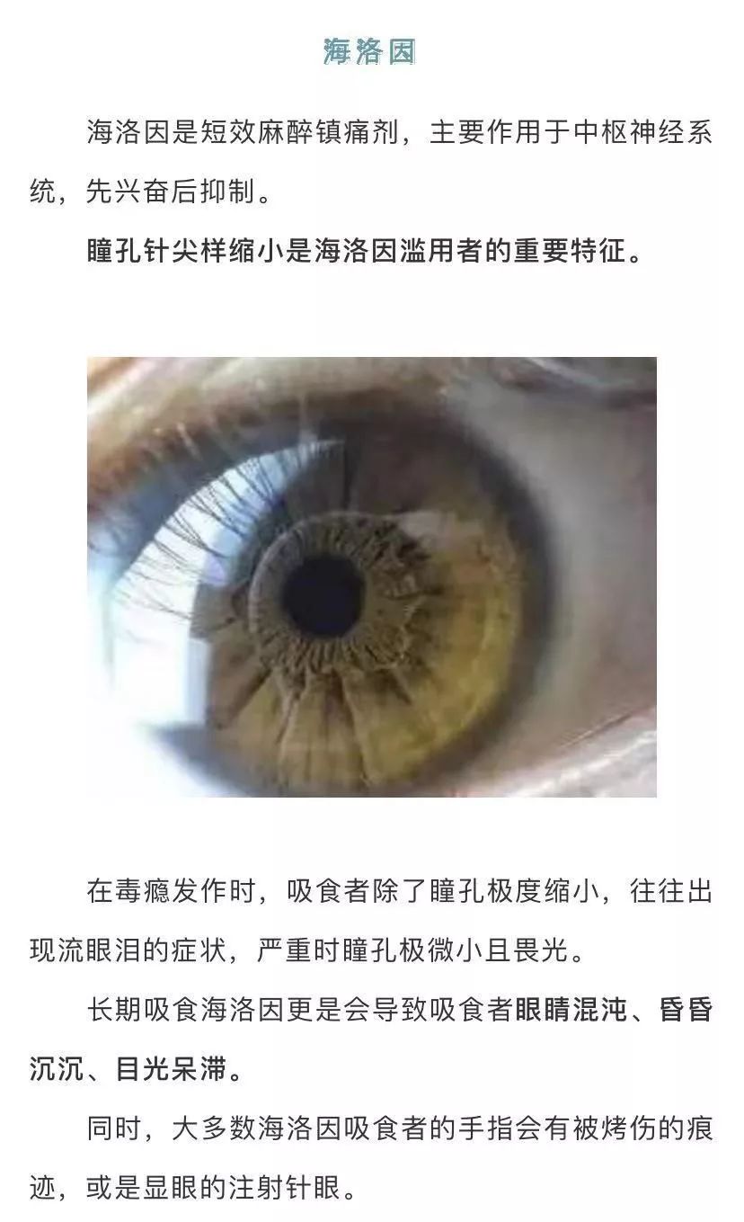 教你从眼睛辨识吸毒者离开毒品才发现那爱笑的眼睛