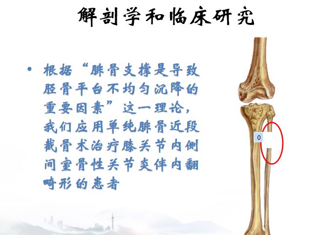 解决患者短期内的疼痛感,而腓骨截骨术则是解决患者长期的关节炎问题