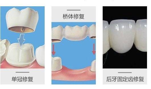 蛀牙痛智齿疼牙松动不知道这几件事你就等着牙齿掉光吧