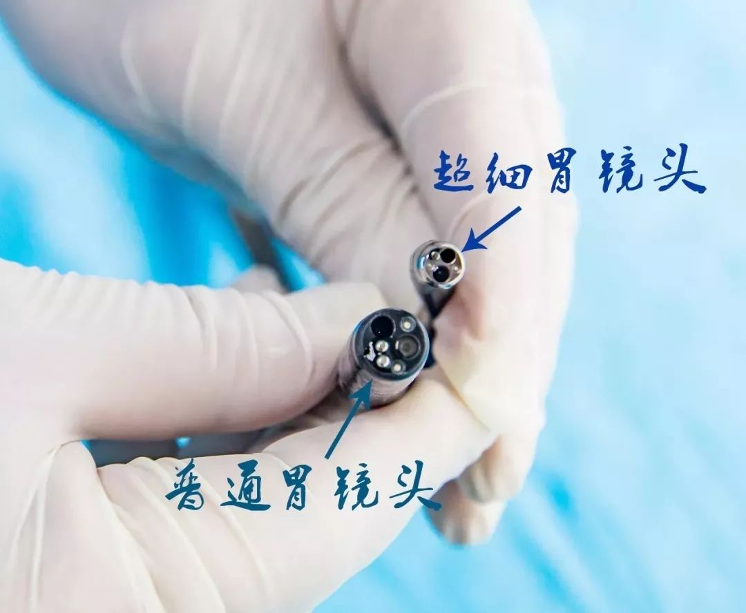 东方总院腔镜内镜中心引进的新设备超细内镜和放大内镜投入使用,随着