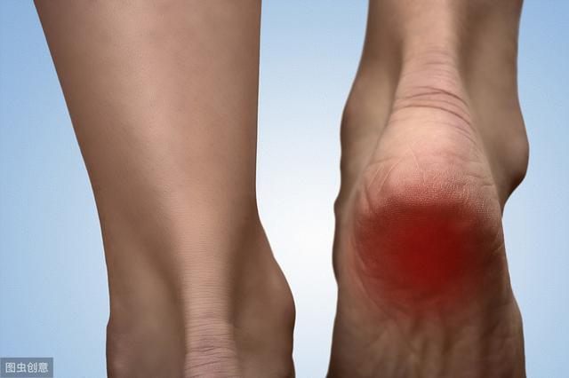 跟腱炎的早期症状并不明显,仅仅为足跟部轻度疼痛或不适感,常常被人