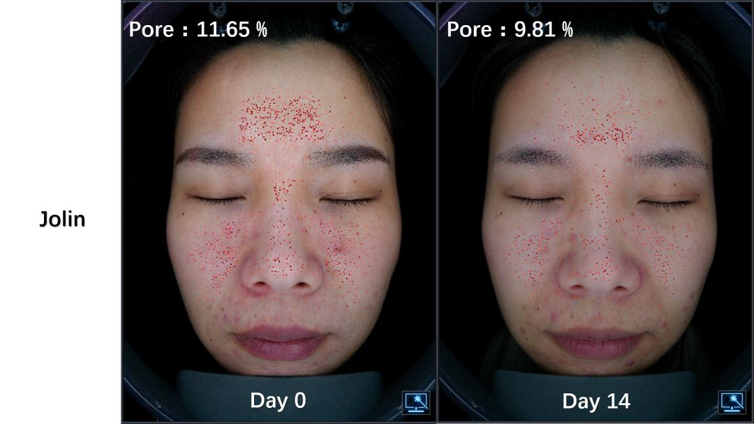 14天的体验反馈,在抗老保养效果的重要指标上(上图第7~11项的光滑透亮