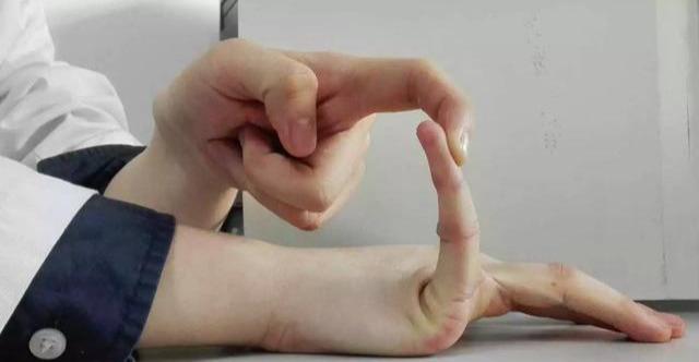 图15.膝关节伸直状态下,双侧手掌接触地面(1分 图5).4.