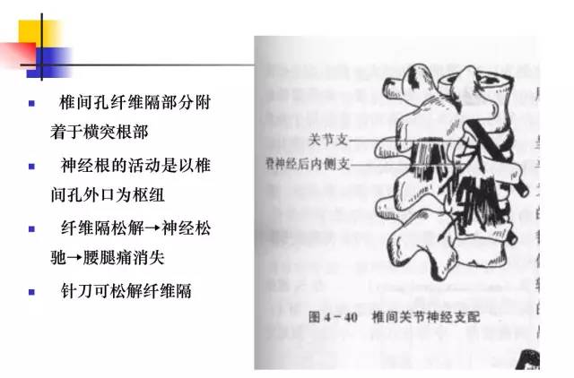 超詳細的腰椎x線解剖及解讀針刀治療腰椎間盤突出症圖文解析針刀人