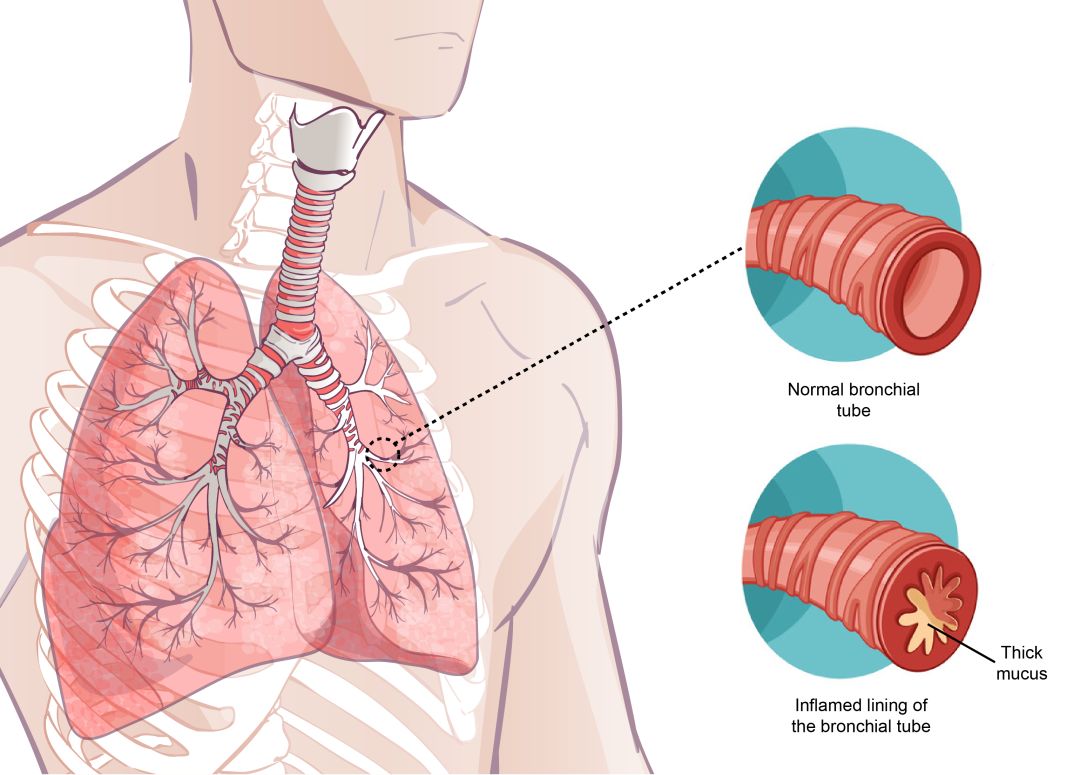 气管分支透明度设置60%选择钢笔工具勾勒出肺部轮廓进行填色描边取消