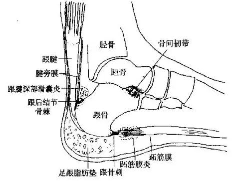 拇展肌,趾短屈肌,小趾展肌第二层:跖方肌,蚓状肌第三层:拇短屈肌