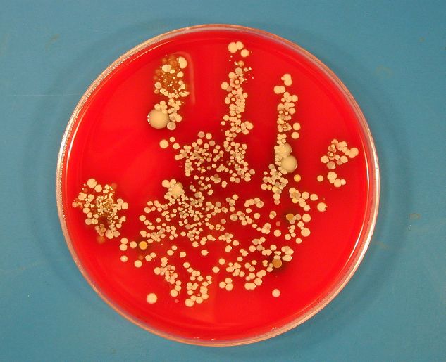 洗手可有效减少手部污染,肥皂或皂液洗手30秒,手部细菌可