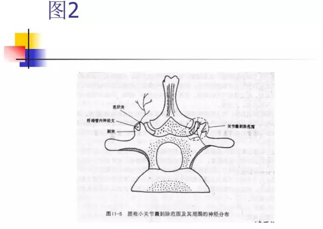 超詳細的腰椎x線解剖及解讀針刀治療腰椎間盤突出症圖文解析針刀人