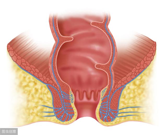 女性患痔疮 到底有多可怕 肛门