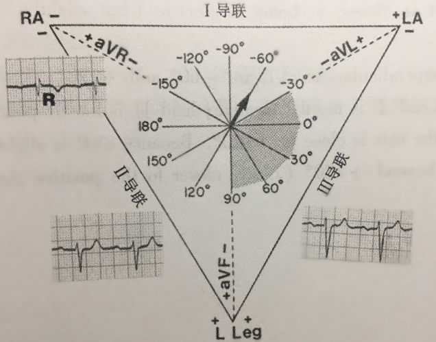 心电轴测量图片