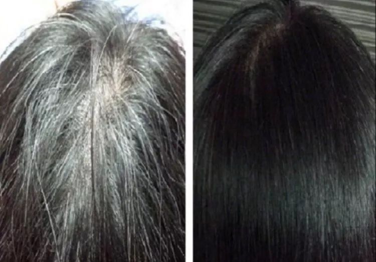 白发越长越多用它28天修复一头自然黑发年轻十几岁