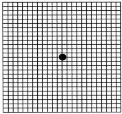 自测黄斑病变的方格图图片