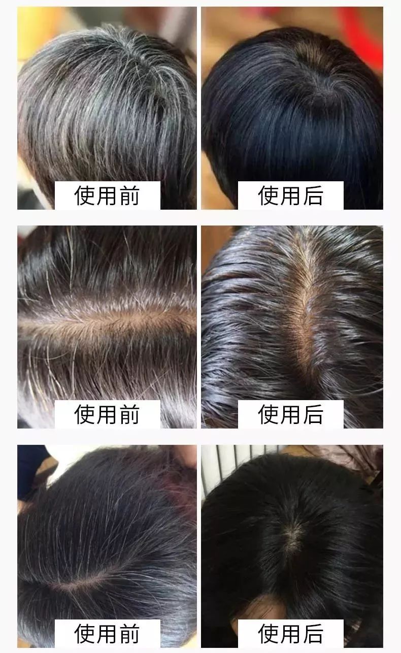 白发越长越多用它28天修复一头自然黑发年轻十几岁